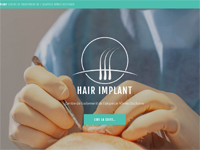 Hair Implant - Centre de traitement de l'alopécie Nîmes Occitanie